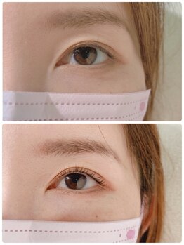 バードアイ(bird eye)/ラッシュリフト