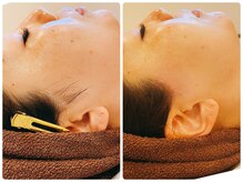 サロンドボーテ サラ(salon de beaute SALA)/美顔ダブル脱毛
