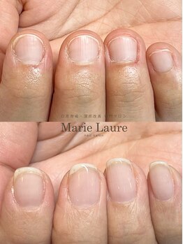 マリーロール 梅田店(Marie Laure)/自爪育成/深爪矯正/ネイルケア
