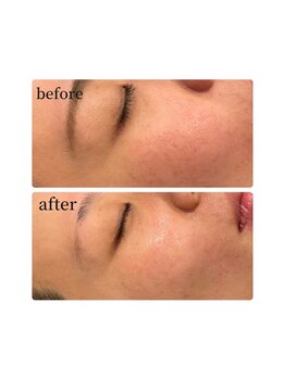 ノノサロン(nono salon)/