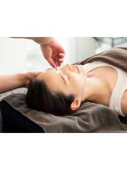 鍼灸施術を受けたい