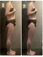 エレラビューティー(ELERA beauty)/お客様before after筋膜リリース