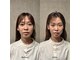 ビアライン オオサカ(Be align Osaka)の写真