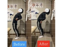 ナオル整体 宮崎院(NAORU整体)/30代男性施術事例【反り腰改善】