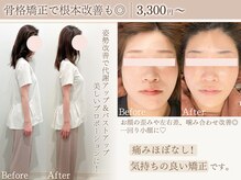 ミーカラー(mecalla.)の雰囲気（小顔矯正＆姿勢矯正/骨格,根本からの美容施術もお任せください◎）