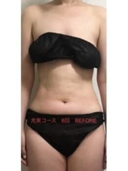 ベルフィーヌ 北千住店(BELFINE)/充実コース 6回 ビフォー 前面