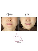 ウルエッテ(UluEtte)/