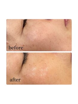 ノノサロン(nono salon)/