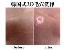 リモレア(RemoLe'a)の雰囲気（【韓国式3D毛穴洗浄】全顔の毛穴＆角質ケアを一度で実感！）