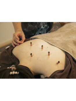 鍼灸施術を受けたい