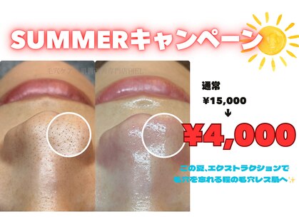 ピエル 北千住店(PIEL)の写真