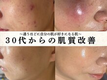 サロン ド エン(Salon de. en)