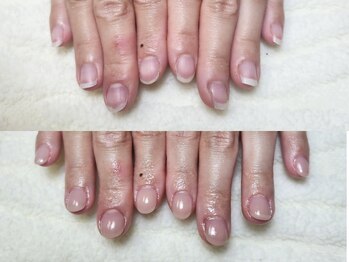 グラシナ なんば店/深爪/自爪育成/フィルイン