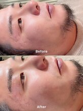 快眠への道 悠々/ハリウッドブロウリフト