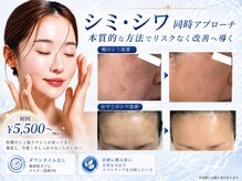 シャルナ(charna)