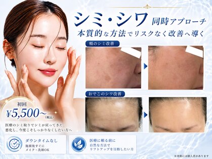 シャルナ(charna)の写真
