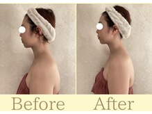 リコ(Rico)/お顔も首もほっそり美人に