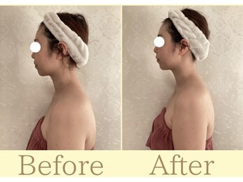 リコ(Rico)/お顔も首もほっそり美人に