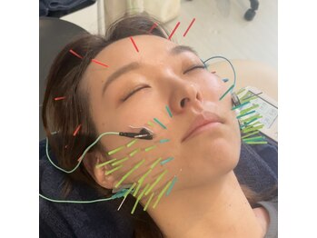 ムーブアクト 福山店(Moveact)/小顔・リフトアップ美容鍼