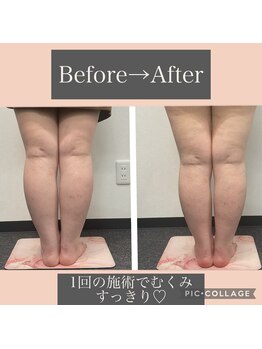 ウエビリア 川越店/むくみ足もすっきり♪