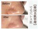 グラシーズ(Glasses)の写真