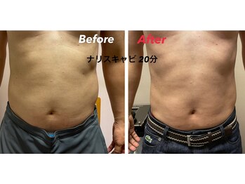 スーパースカルプ 大津店(SuperScalp)/ナリスキャビ