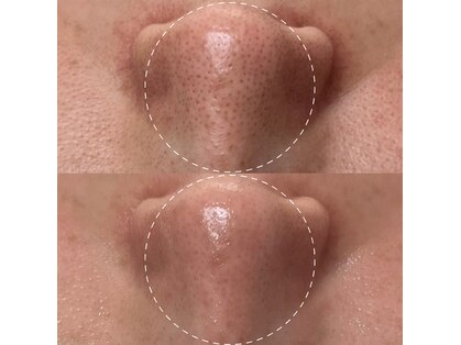 アトリーチェ(ATTRICE)の写真