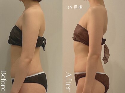 ユーフォリア グロウ(euphoria glow)の写真