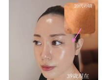 クレール(CLAIR)の雰囲気(エンビロン、プラズマシャワーで大人の本格的な肌質改善に♪)