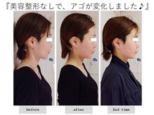 エピファニー(Epiphany)/いつのまにか、、、、顔が長く…