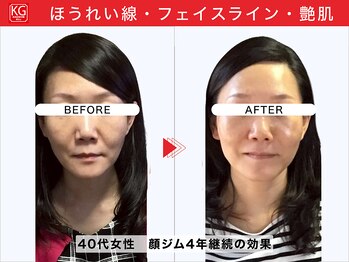 顔ジム 麻布店/顔ジム継続の効果