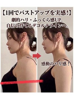 フルジェ(Fulge)/バストを元の位置へ!