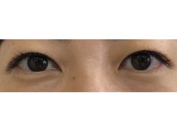 リーベアイラッシュ 東久留米店(Liebe eyelash)/フラットラッシュ100本