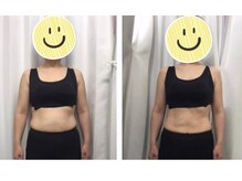 くまがい整体院 若松店/お腹周り引き締めコース