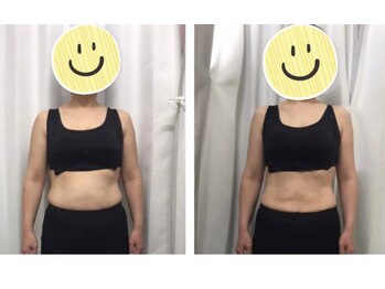 くまがい整体院 若松店/お腹周り引き締めコース