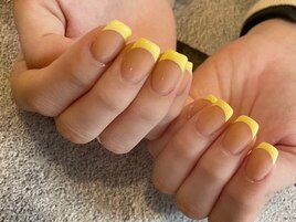 イエローフレンチ♪