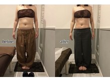 プレミアム ボディ ケア(Premium Body Care)/Before After 【40代】