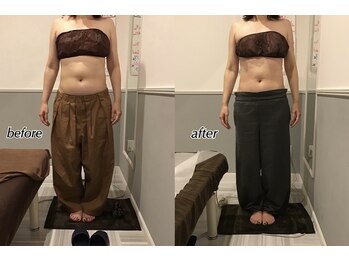 プレミアム ボディ ケア(Premium Body Care)/Before After 【40代】