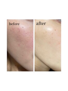 ノノサロン(nono salon)/