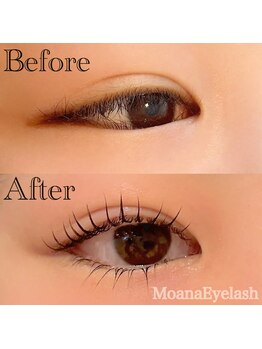 モアナ 逗子 葉山(MOANA)/上下ラッシュリフト