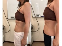 藤田はりきゅう治療院/1回でココまでお腹凹みます