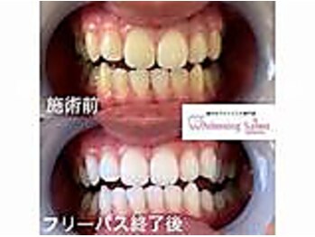 エクシアホワイト 立川南口店/ビフォーアフター