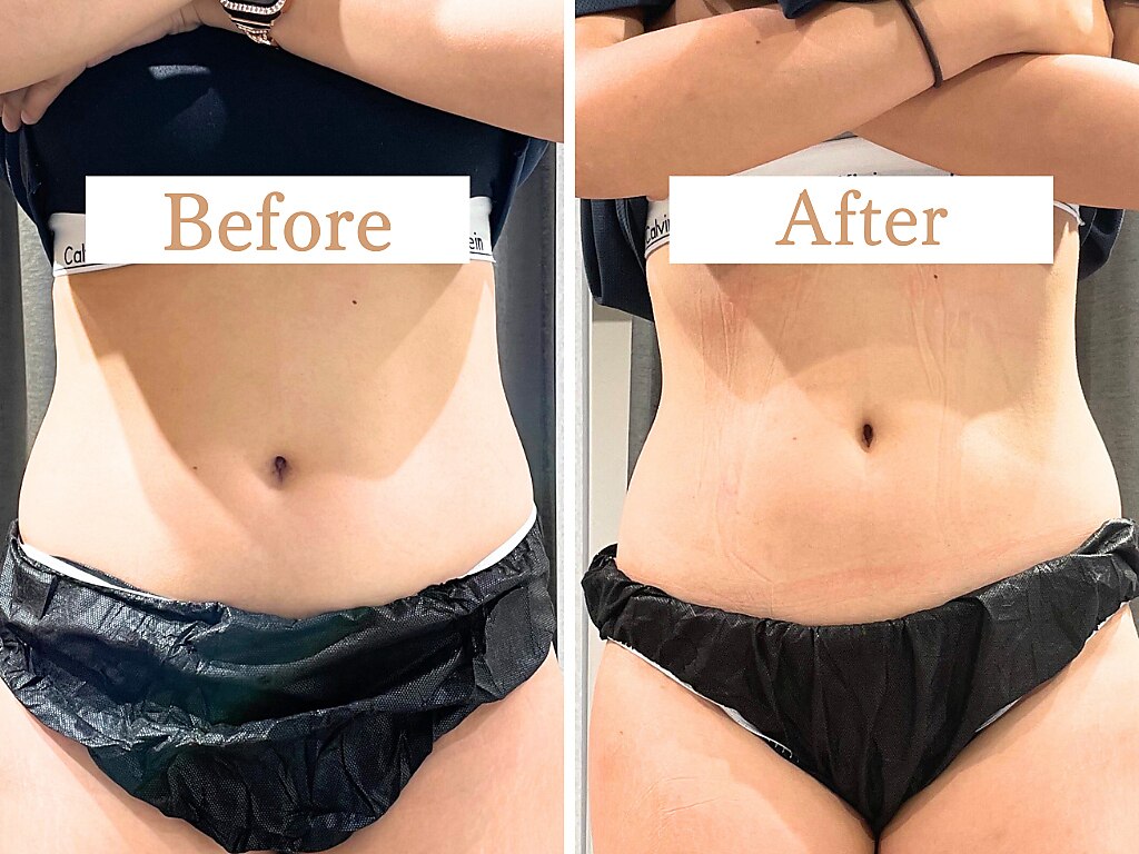 フローフシ∞｜ホットペッパービューティー