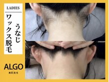 アルゴ 柳川店(ALGO)/うなじWAX脱毛