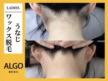 アルゴ 柳川店(ALGO)/うなじWAX脱毛