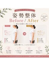 サンシー整体(SunCY整体)/姿勢整体Before/After
