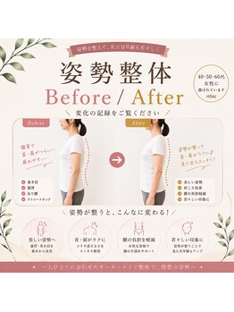サンシー整体(SunCY整体)/姿勢整体Before/After