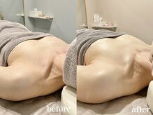 ティアモ(Ti Amo)/Before/After