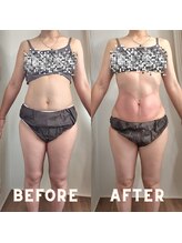 ココノワ(coconoix)/脂肪冷却＆キャビテーション3回