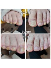 爪切り屋 足楽/届かない、見えない、爪切りには